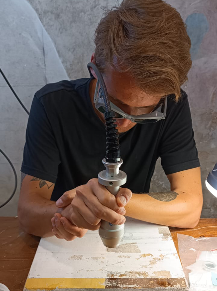 Dani using NdYAG laser-002